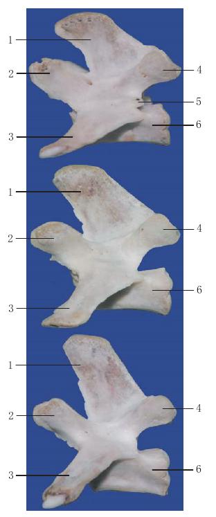 圖1-26 腰椎側(cè)面觀