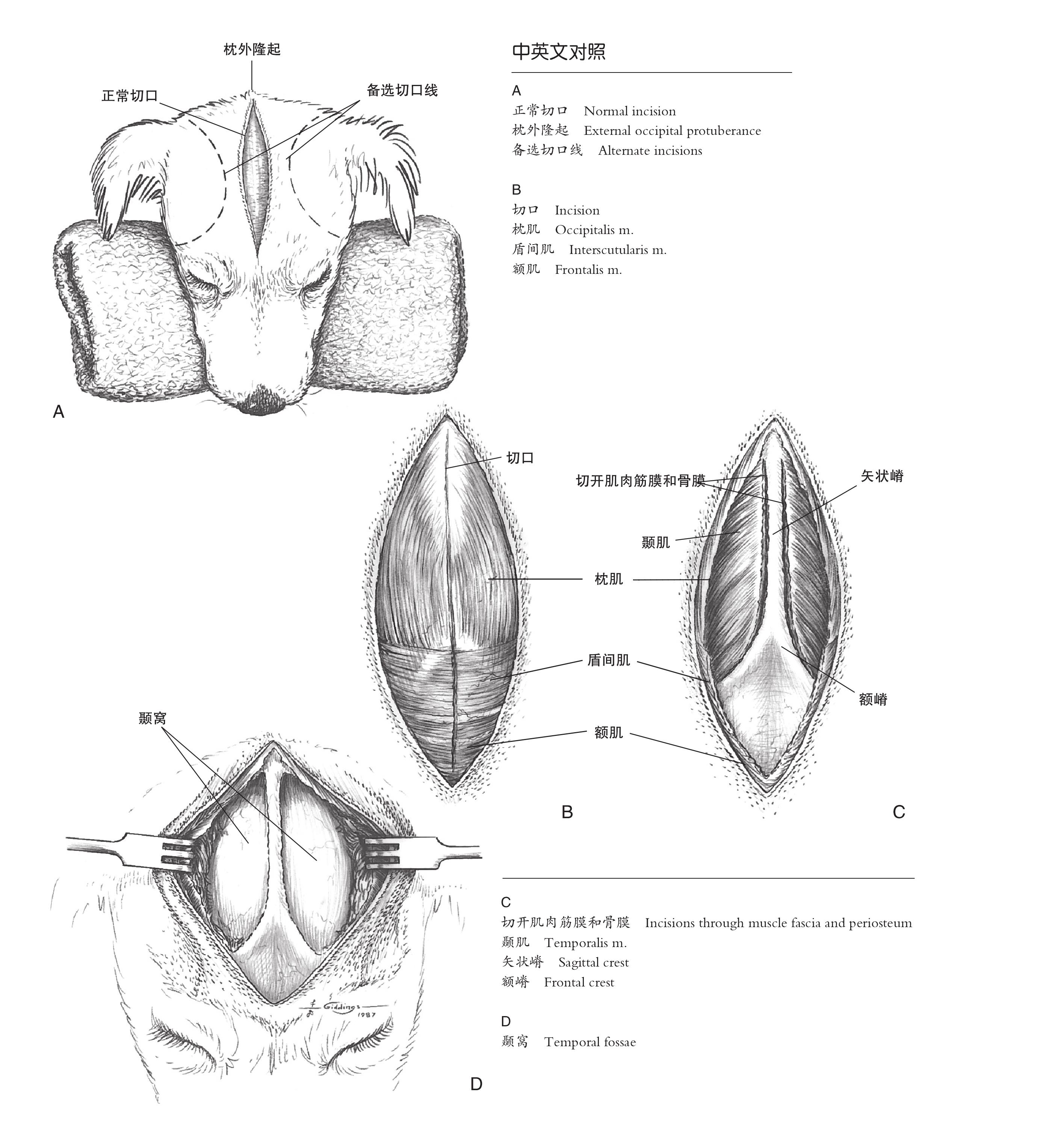 2.5 頭骨背外側(cè)面手術(shù)入路