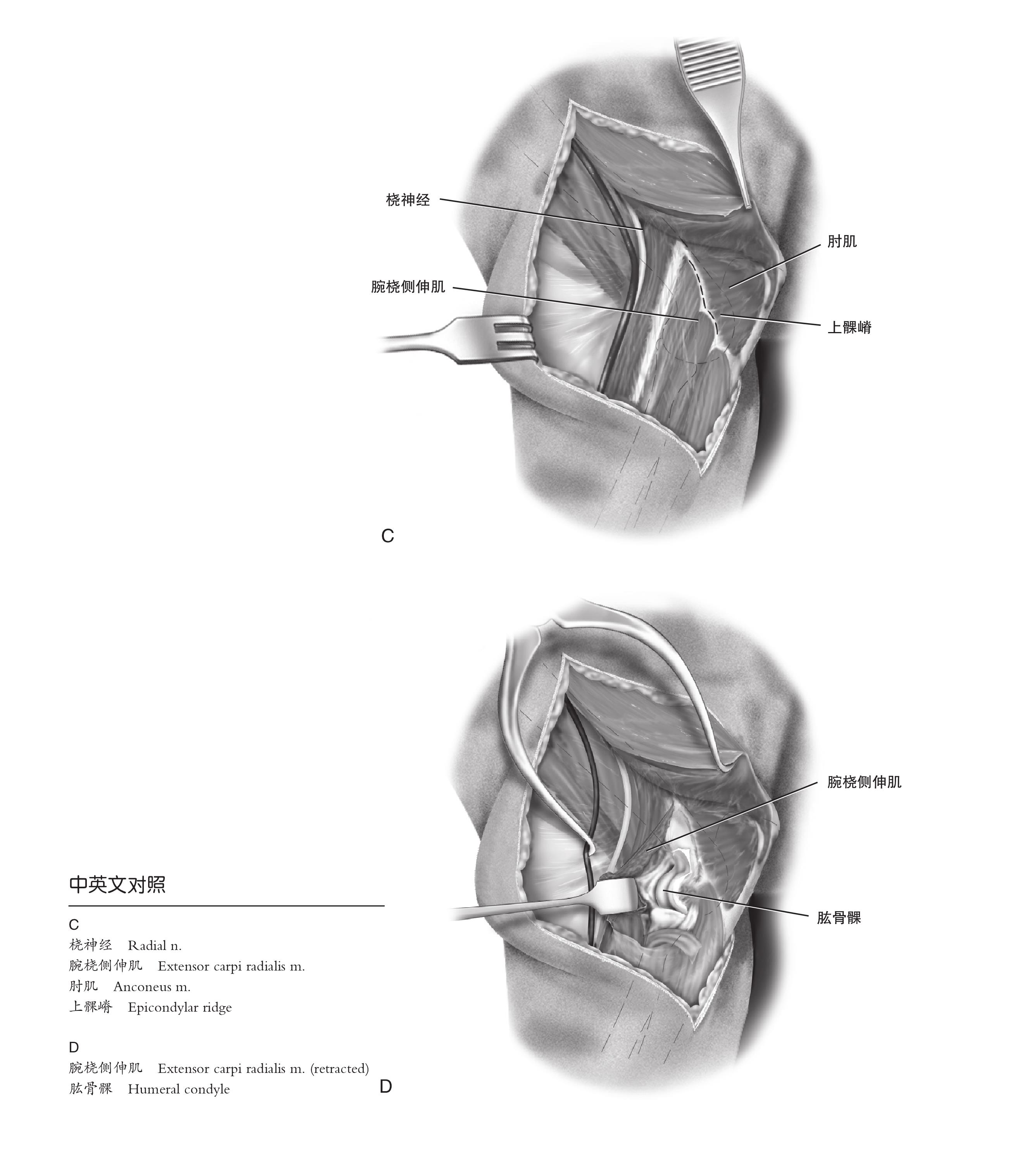 5.8 貓肱骨髁和上髁外側(cè)手術(shù)入路